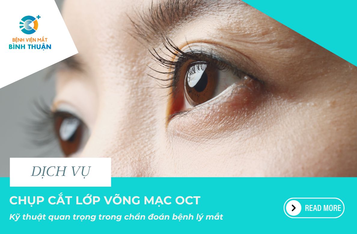 Chụp cắt lớp võng mạc OCT - Kỹ thuật quan trọng trong chẩn đoán bệnh lý mắt