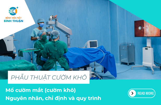 Mổ cườm mắt (cườm khô): Nguyên nhân, chỉ định và quy trình