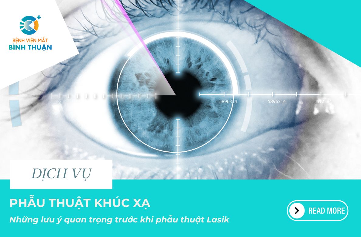 Những lưu ý quan trọng trước khi phẫu thuật Lasik