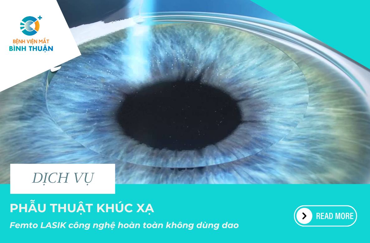 Phẫu thuật Femto - Lasik Femto công nghệ xoá cận hoàn toàn không dùng dao