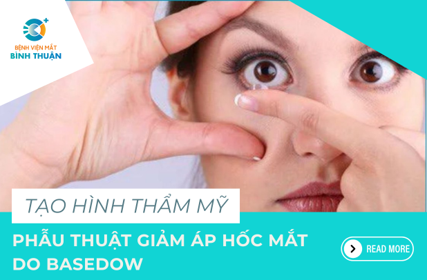 Tìm hiểu phương pháp phẫu thuật giảm áp hốc mắt do Basedow