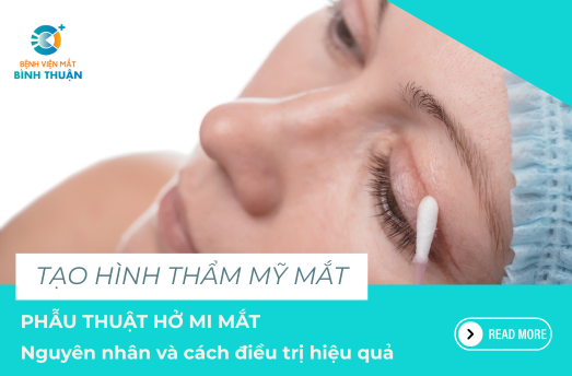 Phẫu thuật hở mi mắt: Nguyên nhân và cách điều trị hiệu quả