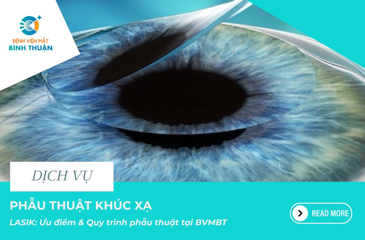 Phẫu thuật khúc xạ Lasik: Ưu điểm & Quy trình phẫu thuật tại BVMBT