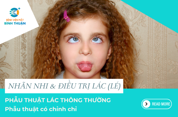 Phẫu thuật lác thông thường - Phẫu thuật có chỉnh chỉ
