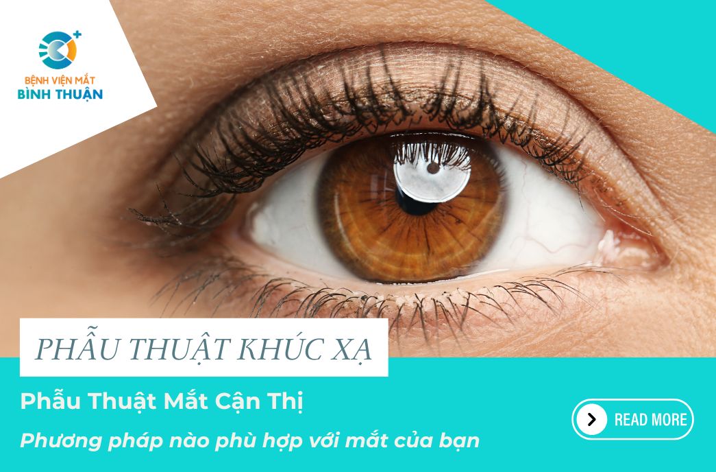 Phẫu thuật mắt cận thị: Phương pháp nào phù hợp với mắt của bạn