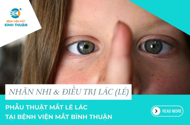 PHẪU THUẬT MẮT LÉ LÁC TẠI BỆNH VIỆN MẮT BÌNH THUẬN