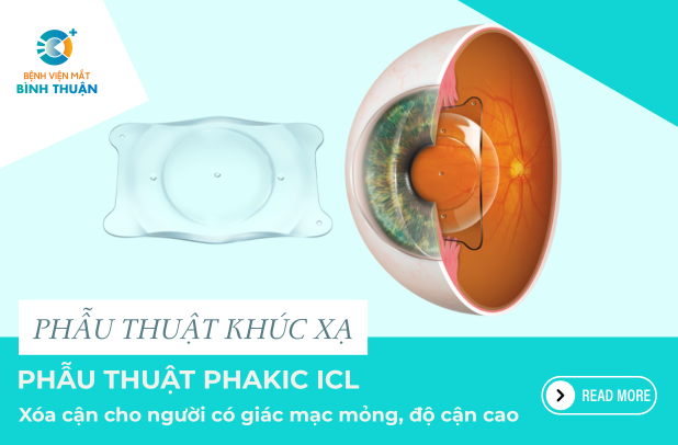 Phẫu thuật Phakic ICL - Xóa cận cho người có giác mạc mỏng, độ cận cao