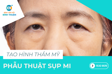 PHẪU THUẬT SỤP MI 
