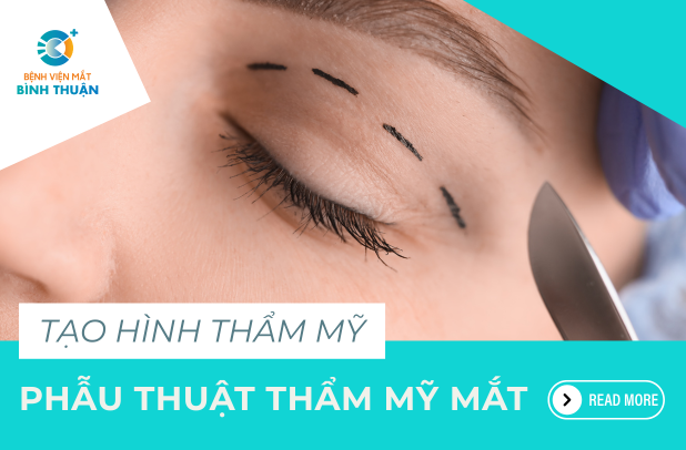 PHẪU THUẬT THẨM MỸ MẮT 