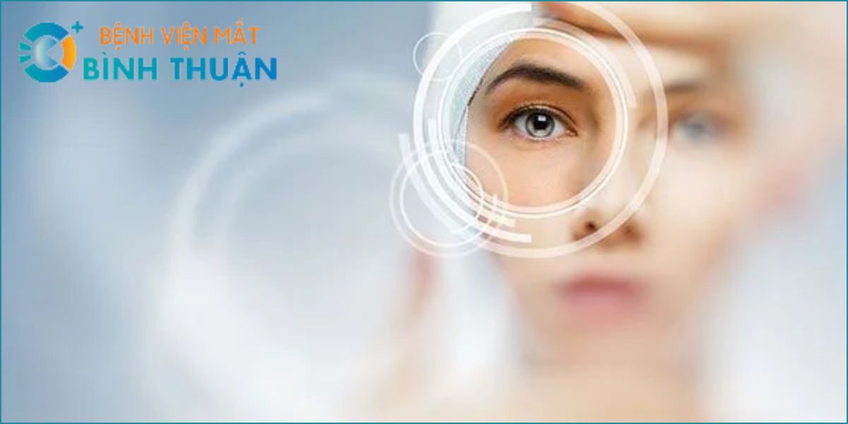 PHƯƠNG PHÁP ĐIỀU TRỊ TẬT KHÚC XẠ EPI LASIK