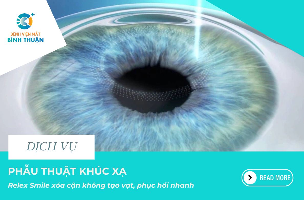 Phương pháp Relex Smile xóa cận không tạo vạt, phục hồi nhanh